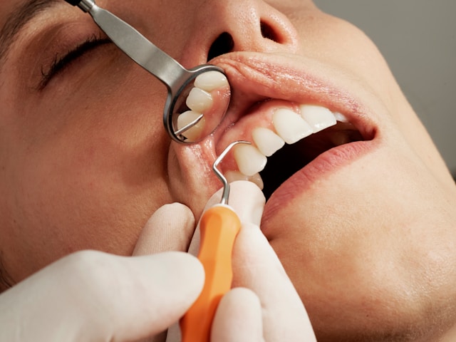 How to Choose the Right Cosmetic Dentist